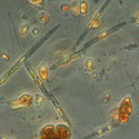 Actuación para determinar posibles toxinas por fitoplancton en el Mar Menor