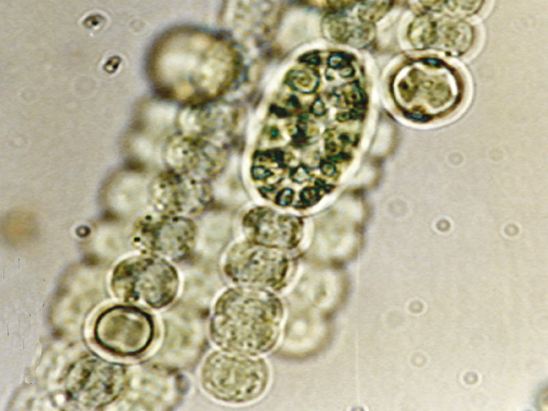 Fotografía bacteria microscópica