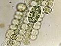 Fotografía bacteria microscópica