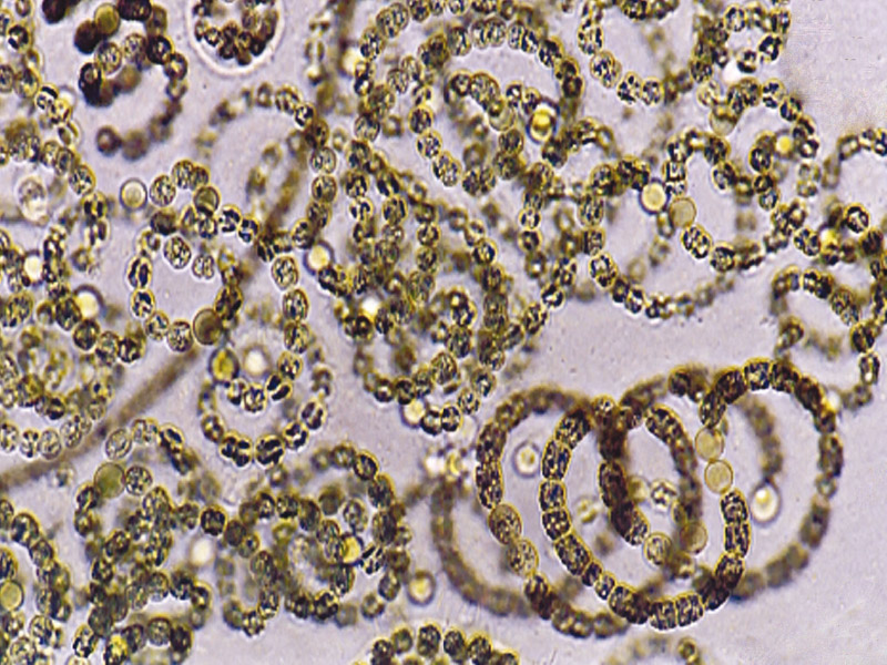 Fotografía bacteria microscópica