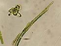 Fotografía bacteria microscópica